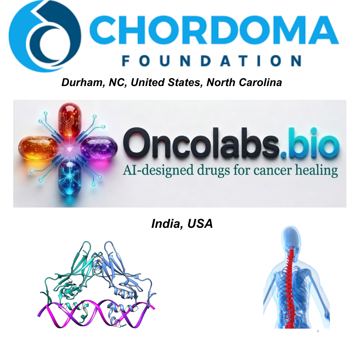 chordoma